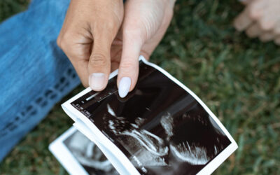 Conceiving After Amenorrhea Due to Hyperprolactinemia