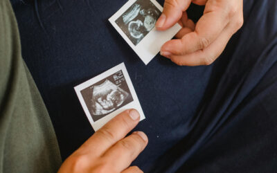 The Happy Outcome After Complex Male Infertility